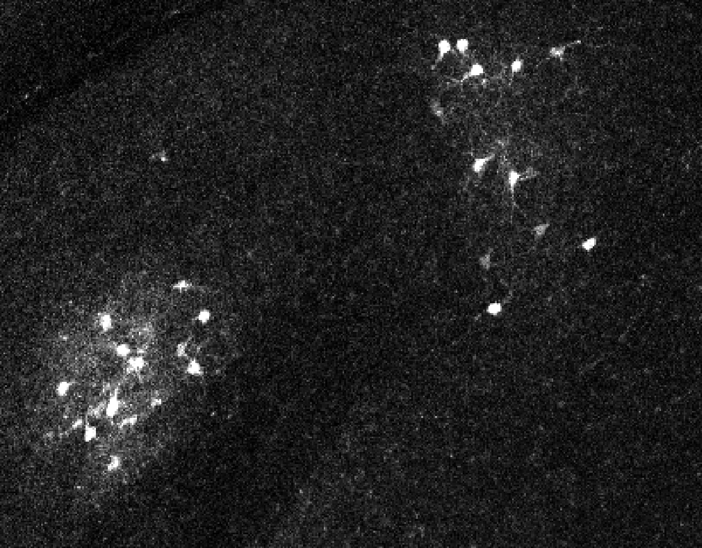 A closeup of some fluorescently labelled cells
